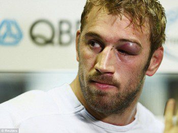 Robhsaw played through pain, and cemented his position as England captain.