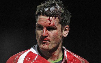 This picture just about sums up Freddie Burns' 2013. 