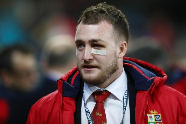 Stuart Hogg's tour is over after he fractured a cheek bone in a collision with his own team mate against the Crusaders. 