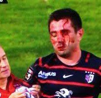Scandal: Florian Fritz was injured in last week's Top 14 play-off between Toulouse and Racing Metro