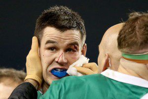 Jonny Sexton is treated for a cut during Ireland's Six Nations win over France in Dublin